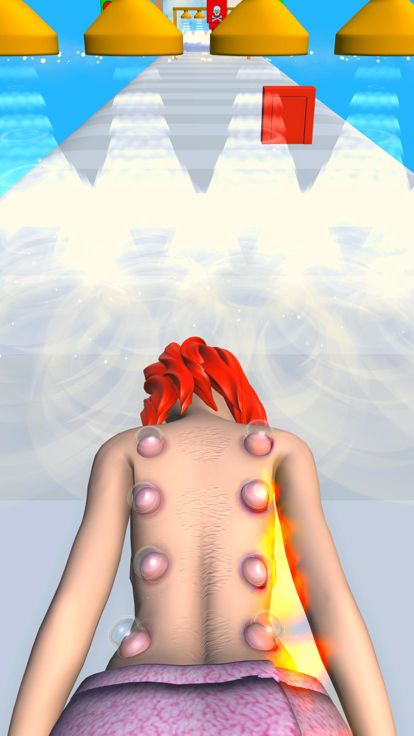 Cupping Treatment游戏截图
