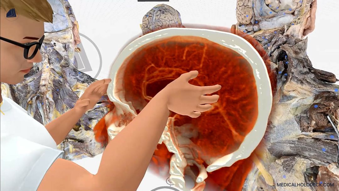 MEDICALHOLODECK®。虚拟现实中的外科、解剖学、医学和DICOM。适用于医学生、护士、医生和外科医生。游戏截图