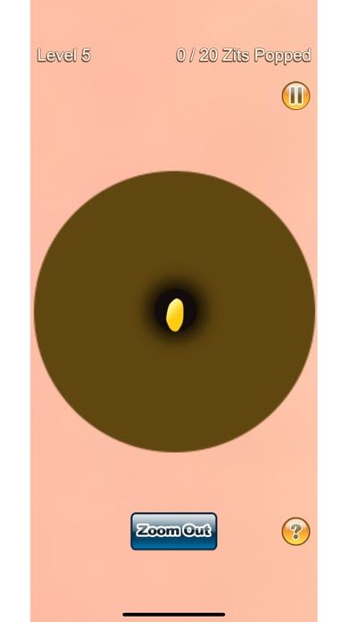 Pimple Popper游戏截图