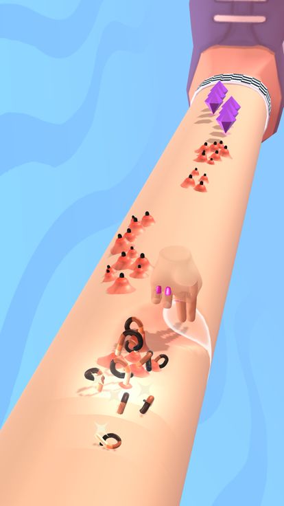 Acne ASMR游戏截图