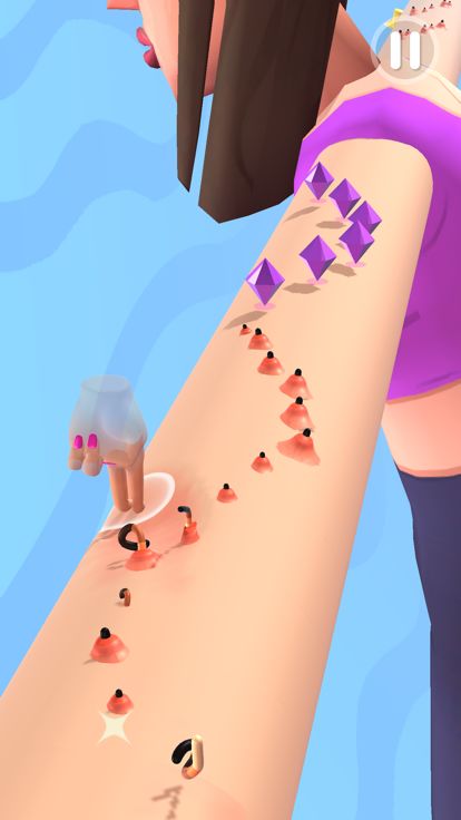 Acne ASMR游戏截图