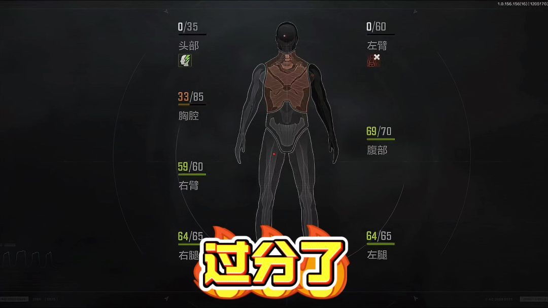 video-4610411