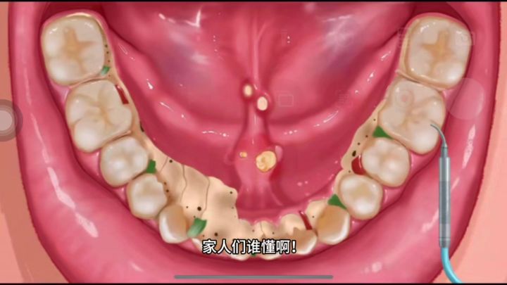 口腔大冒险:清洁大师养成记截图