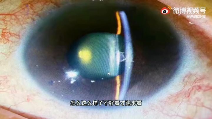 【3DM游戏网】21岁女孩关灯玩手机引发白内障截图